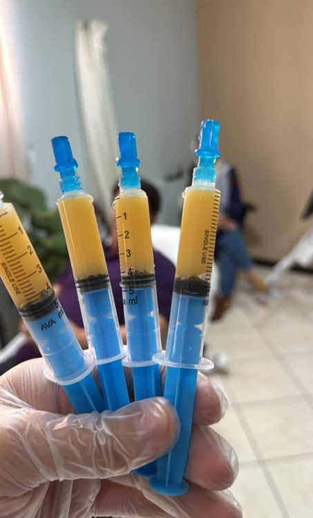 خرید دستگاه پلاسما ژل (بایوفیلر) | قیمت پلاسما ژل رویان ایران