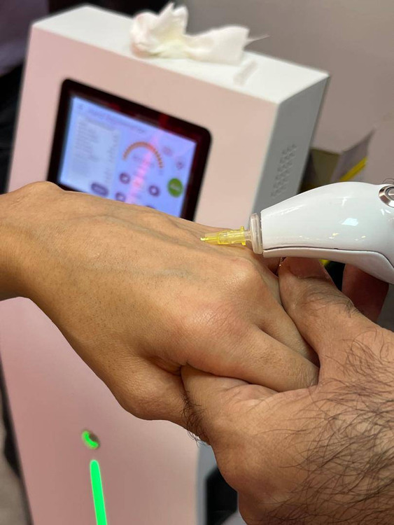 دستگاه کربوکسی تراپی هوشمند آپولون